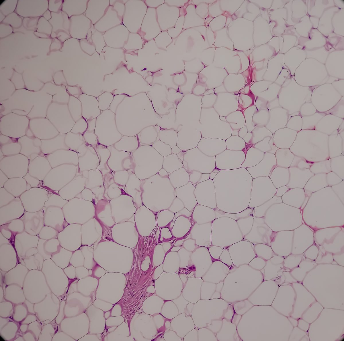 Vetcellen onder de microscoop.