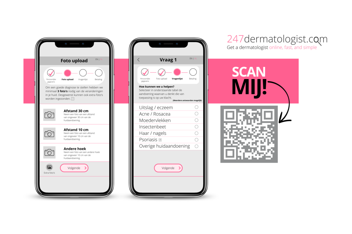 online dermatoloog