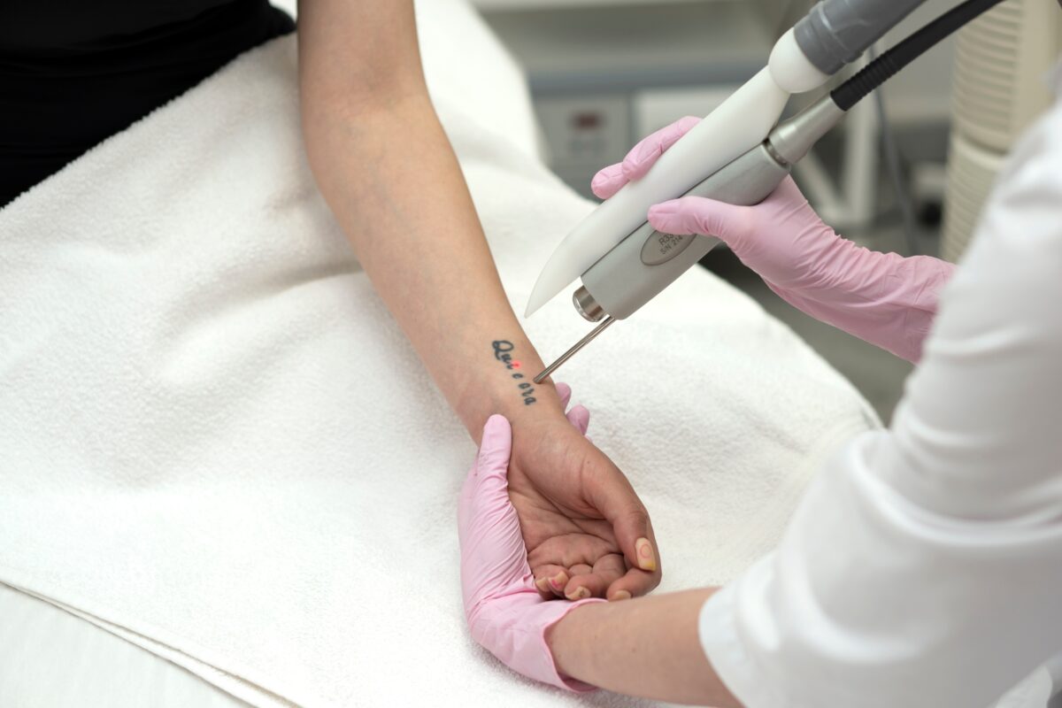 tatoeage verwijderen